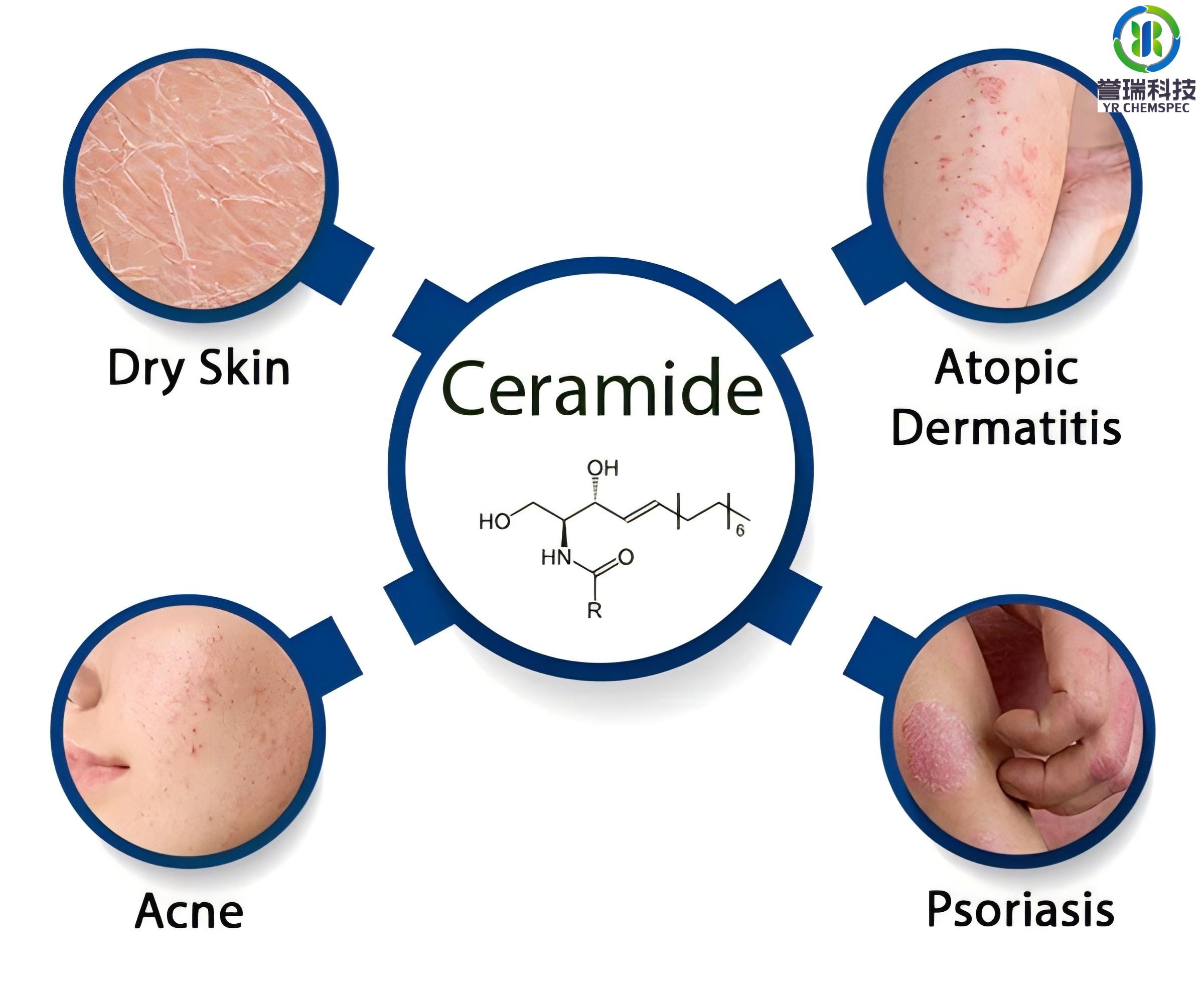 ceramide-1.jpg