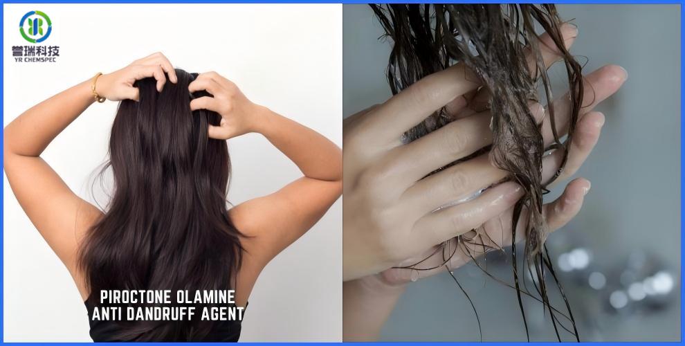 Piroctone Olamine: The Ultimate Solution For Dandruff And Other Hair Problems