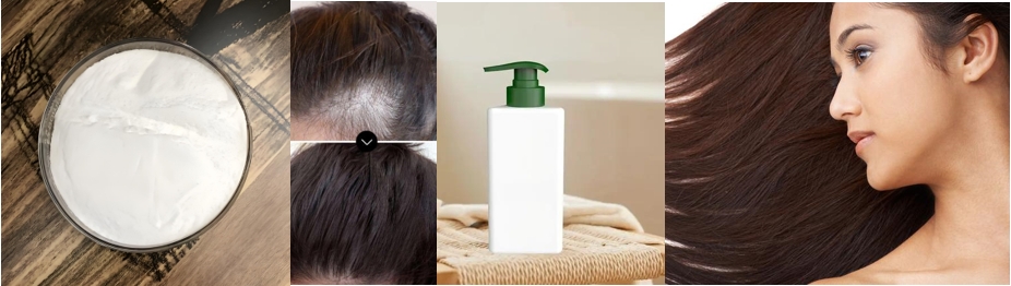 Diaminopyrimidine Oxide anti-hair loss