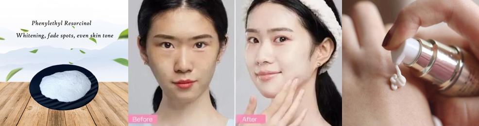 Phenylethyl Resorinol skin lightening