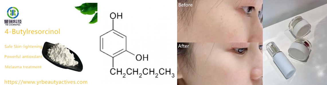 4-BUTYLRESORCINOL skin-lightening
